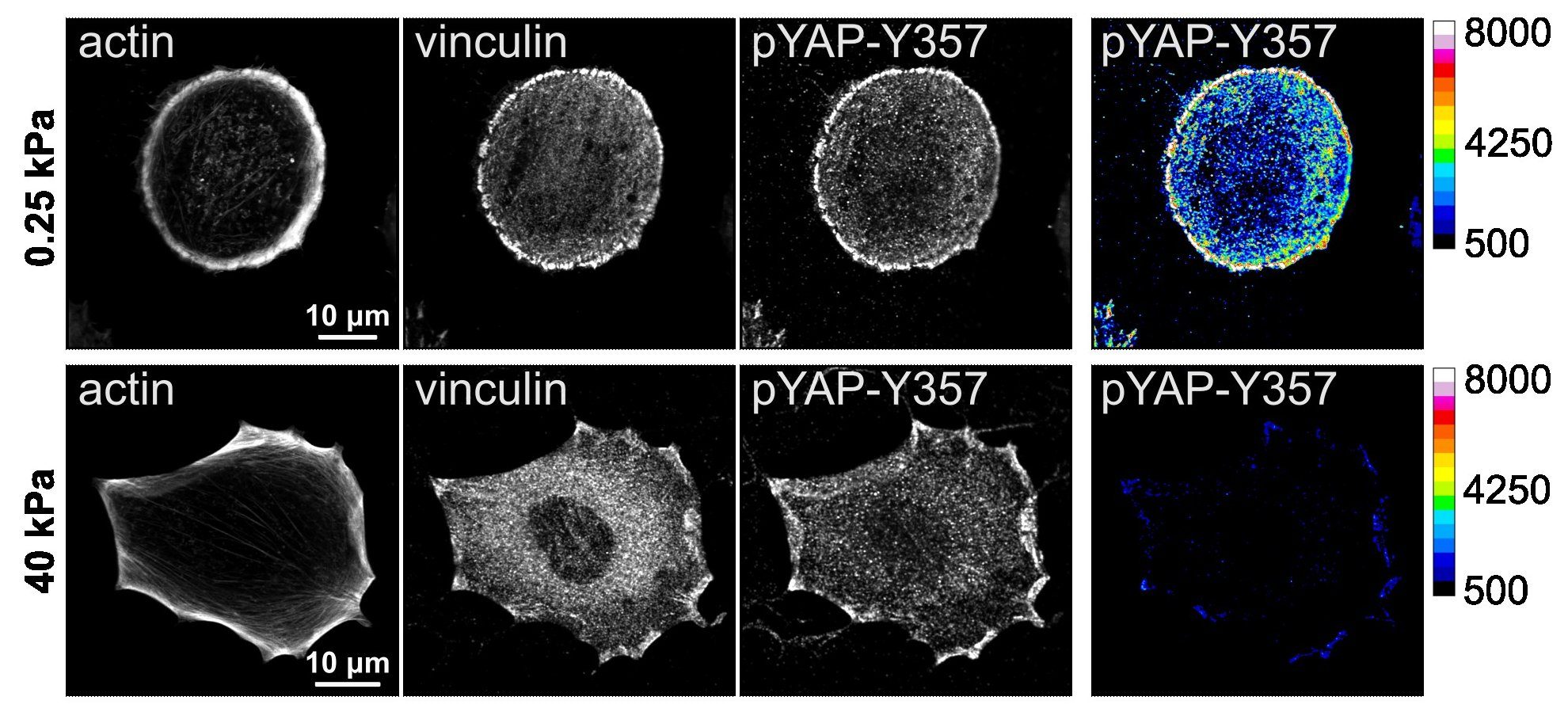 Images of cells stained for actin, vinculin, pYAP