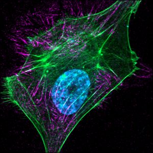 Image of a cell stained for actin (green) and fibronectin (magenta)